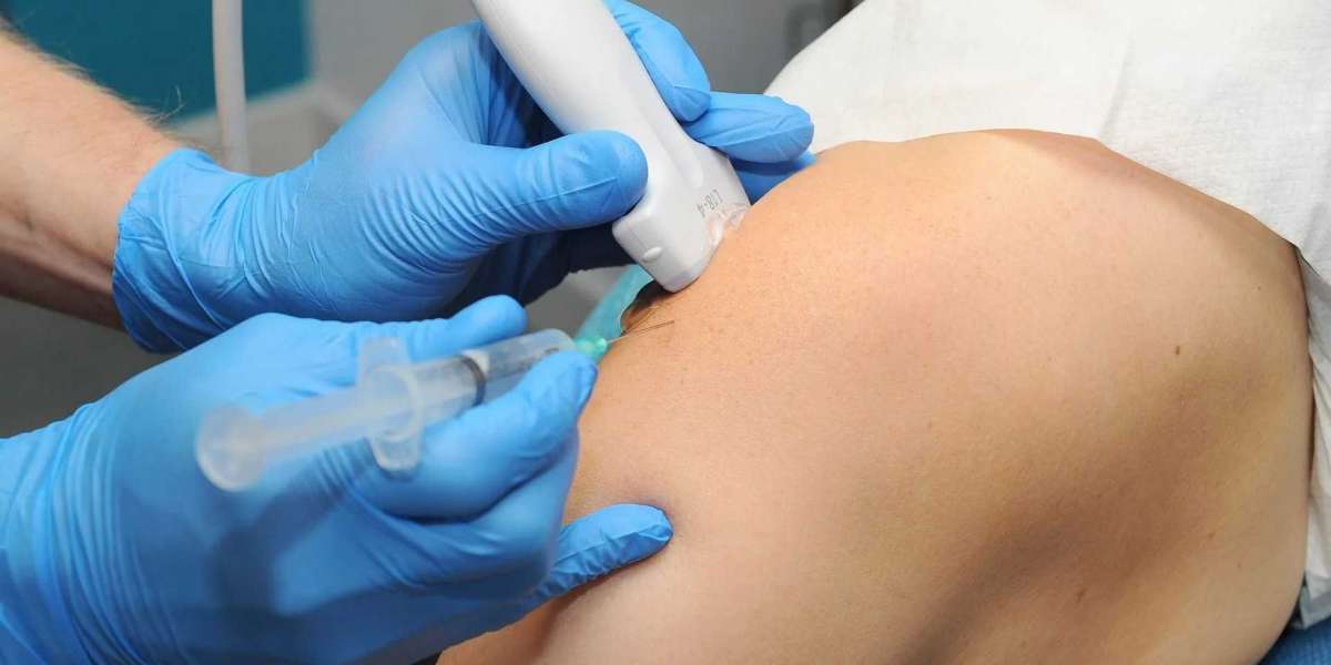 Maximizing Precision and Efficacy: The Role of Ultrasound Guided Injections